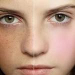 xoa tan nhang 150x150 - Review serum Hanvely chống lão hóa tốt nhất hiện nay